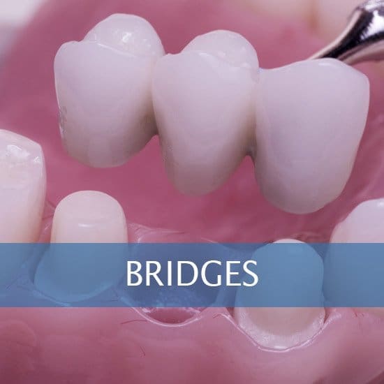 Bridges - Crowns - Dental Hygene - Teeth Whitening - Veneers - Dental Implants - Dentures - Exractions - Root Canals, Crown Lenghtening - Post Op Instructions - Framingham Dentists, Unique Dental of Framingham. Bridges - Crowns - Dental Hygene - Teeth Whitening - Veneers - Dental Implants - Dentures - Exractions - Root Canals, Crown Lenghtening - Post Op Instructions - Framingham Dentists, Unique Dental of Framingham.