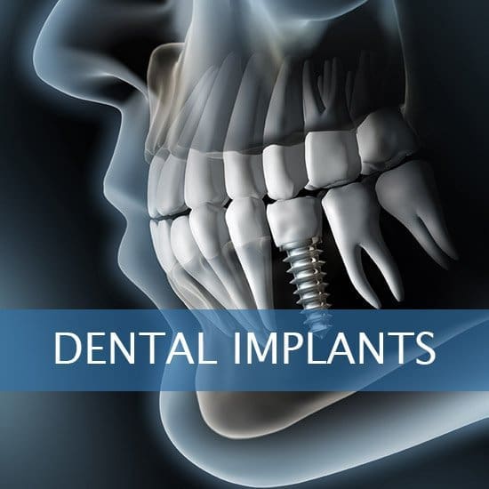 Dental Implants - Dentures - Exractions - Root Canals, Crown Lenghtening - Post Op Instructions - Framingham Dentists, Unique Dental of Framingham. Dental Implants - Dentures - Exractions - Root Canals, Crown Lenghtening - Post Op Instructions - Framingham Dentists, Unique Dental of Framingham.