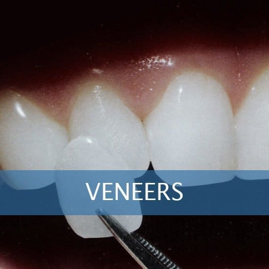 Veneers - Dental Implants - Dentures - Exractions - Root Canals, Crown Lenghtening - Post Op Instructions - Framingham Dentists, Unique Dental of Framingham. Veneers - Dental Implants - Dentures - Exractions - Root Canals, Crown Lenghtening - Post Op Instructions - Framingham Dentists, Unique Dental of Framingham.
